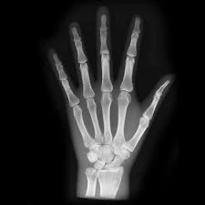 XR HAND